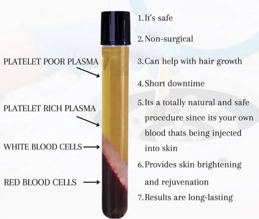 Benefits of PRP Treatment