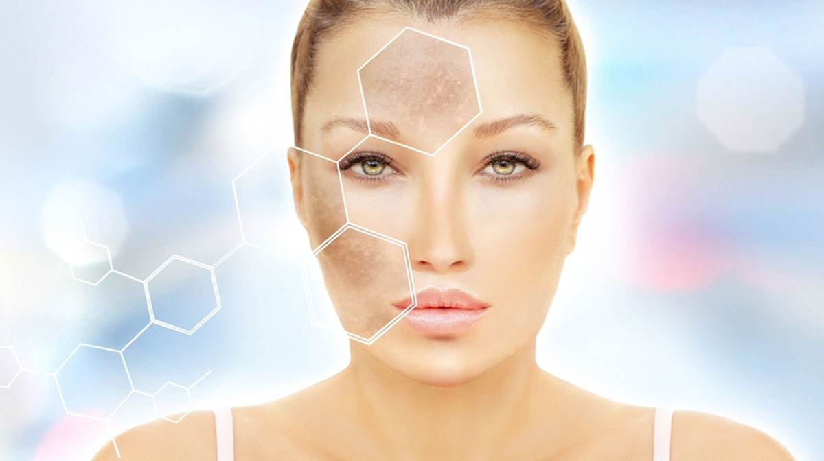 Pigmentation Removal Treatment In Mumbai at Mumbai Cosmetic Centre